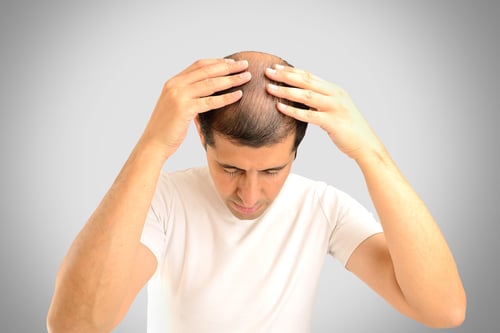 man controls hair loss with gray