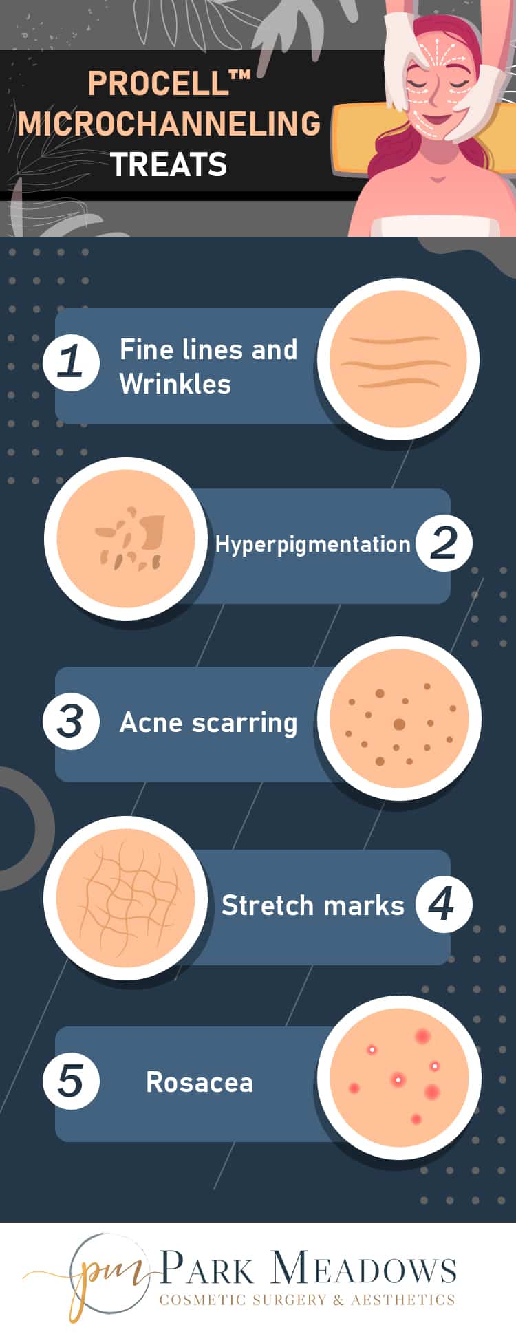 procell microchanneling infographic, showing conditions treated, including fine lines and wrinkles, hyperpigmentation, acne scarring, stretch marks, and rosacea