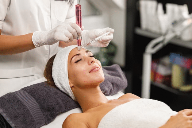 microneedling