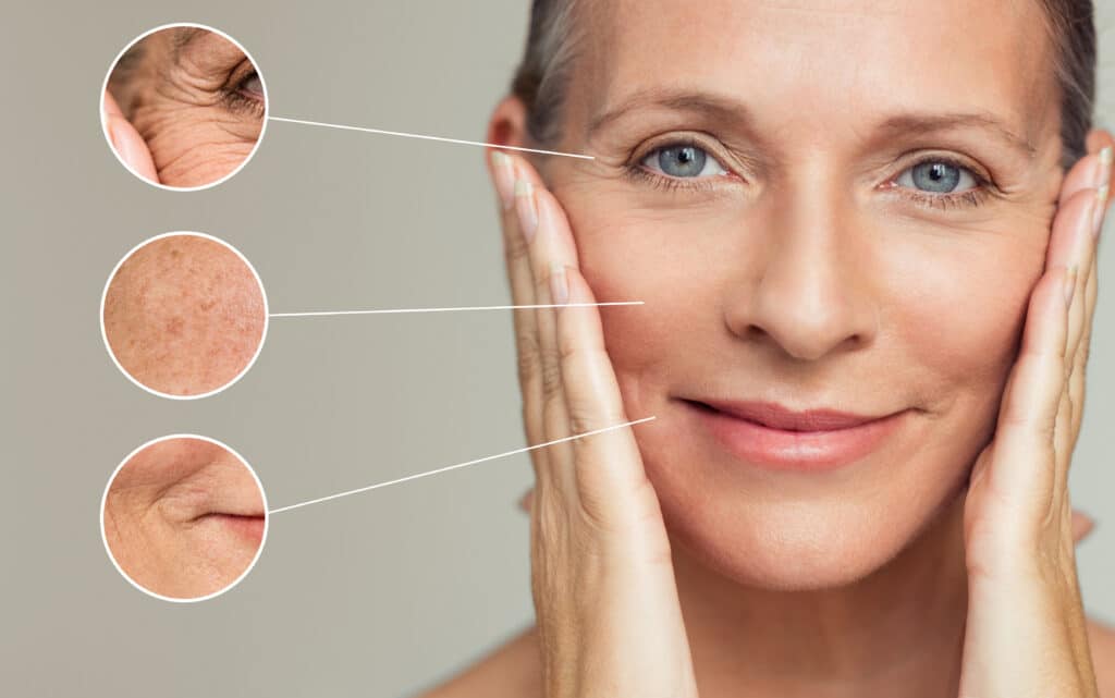 Middle-aged woman touching her face, with close-up insets highlighting wrinkles in different areas
