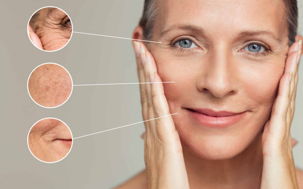 Middle-aged woman touching her face, with close-up insets highlighting wrinkles in different areas